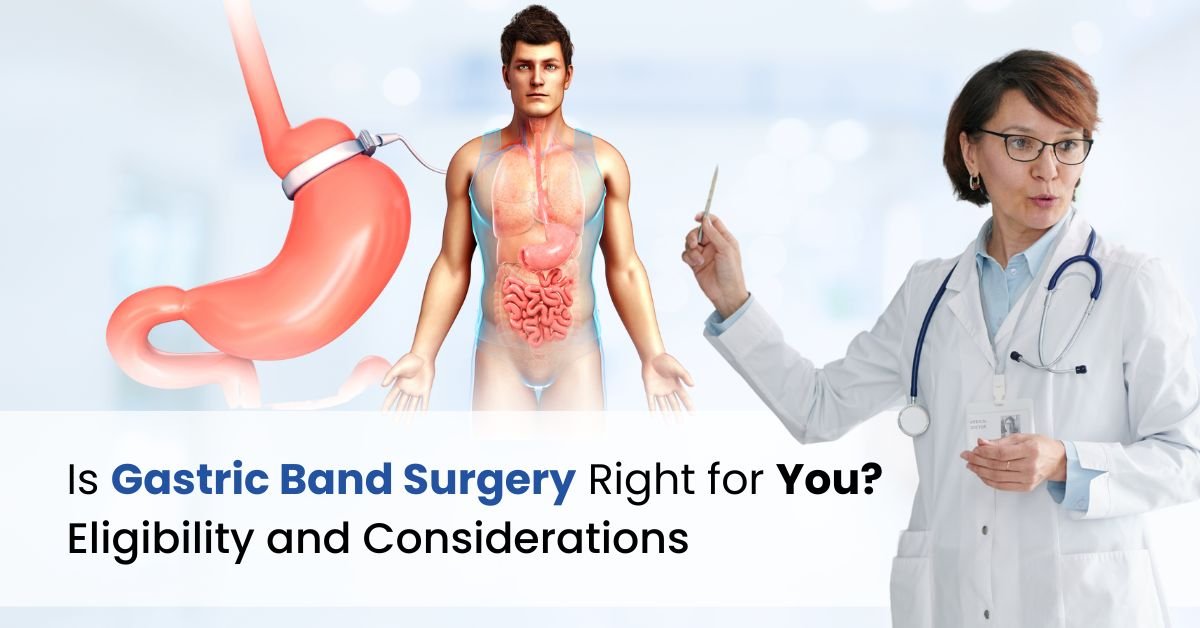 Is Gastric Band Surgery Right for You? Eligibility and Considerations